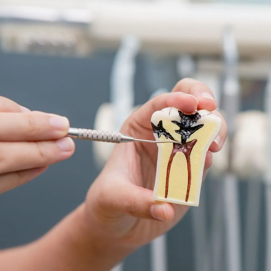 endodoncista mostrando un tratamiento de conducto
