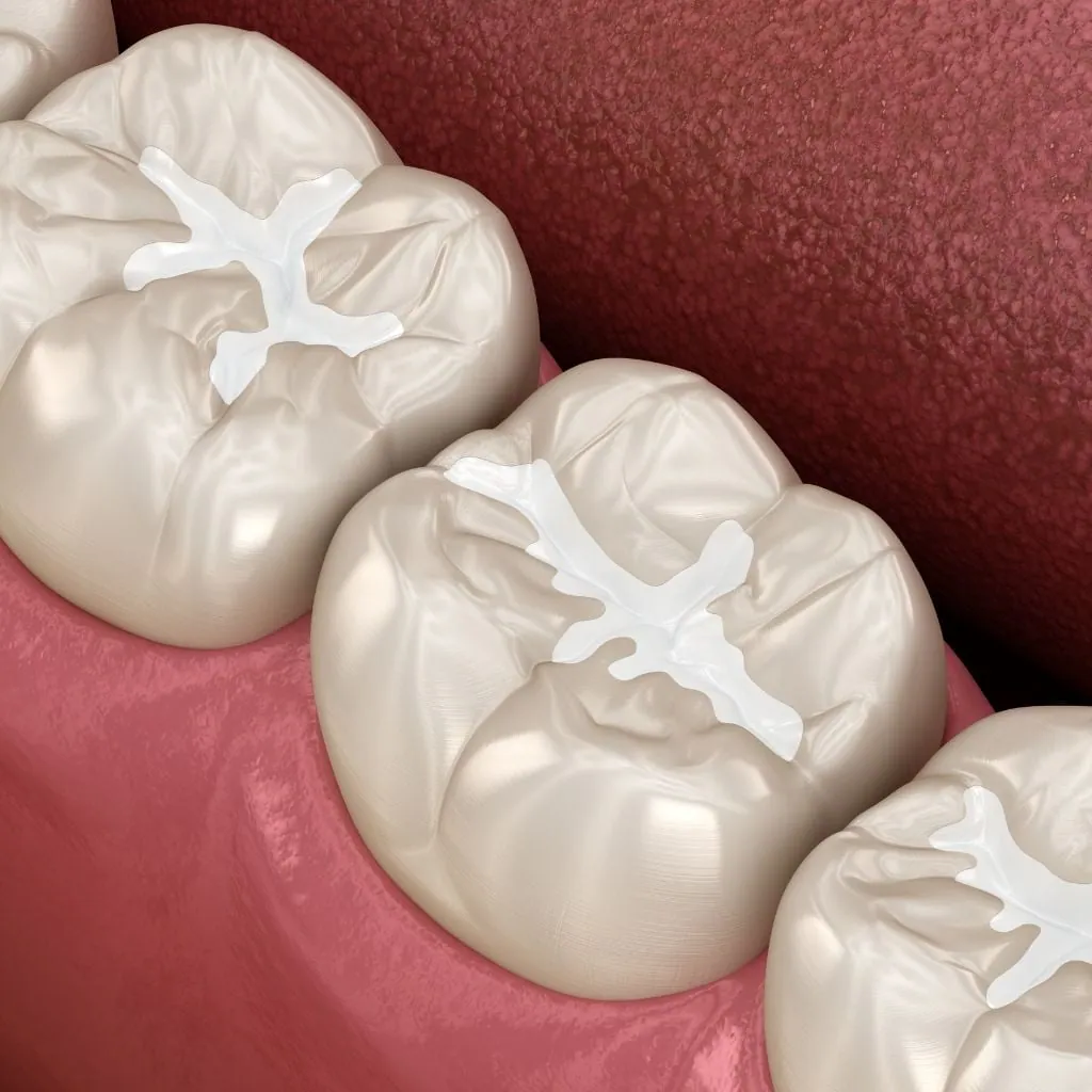 tipos de empastes dentales