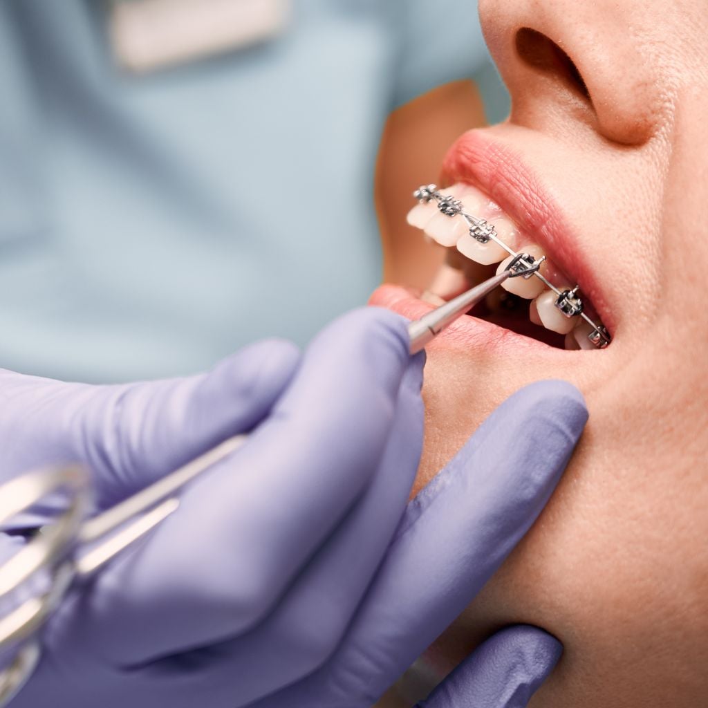 a patient during an orthodontic check