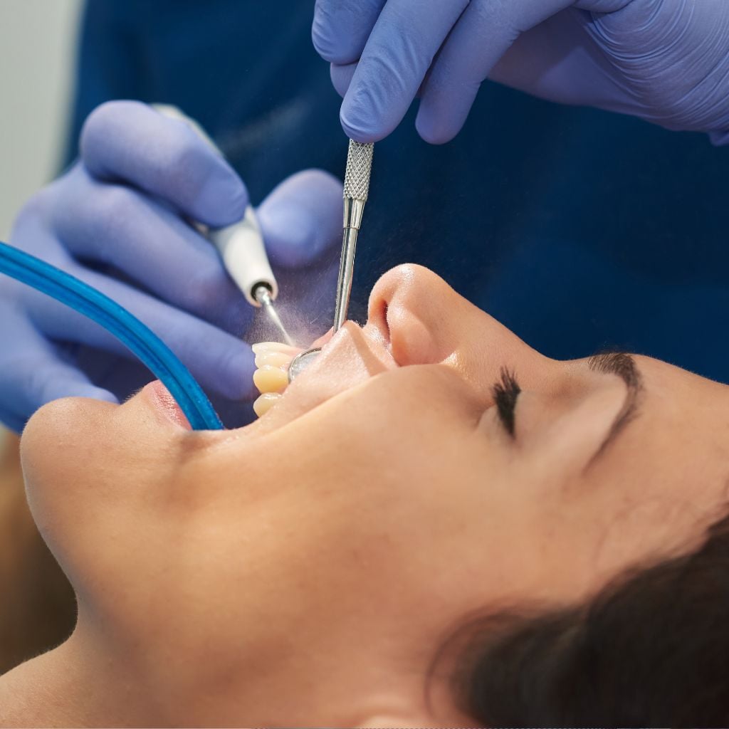 dental cleaning