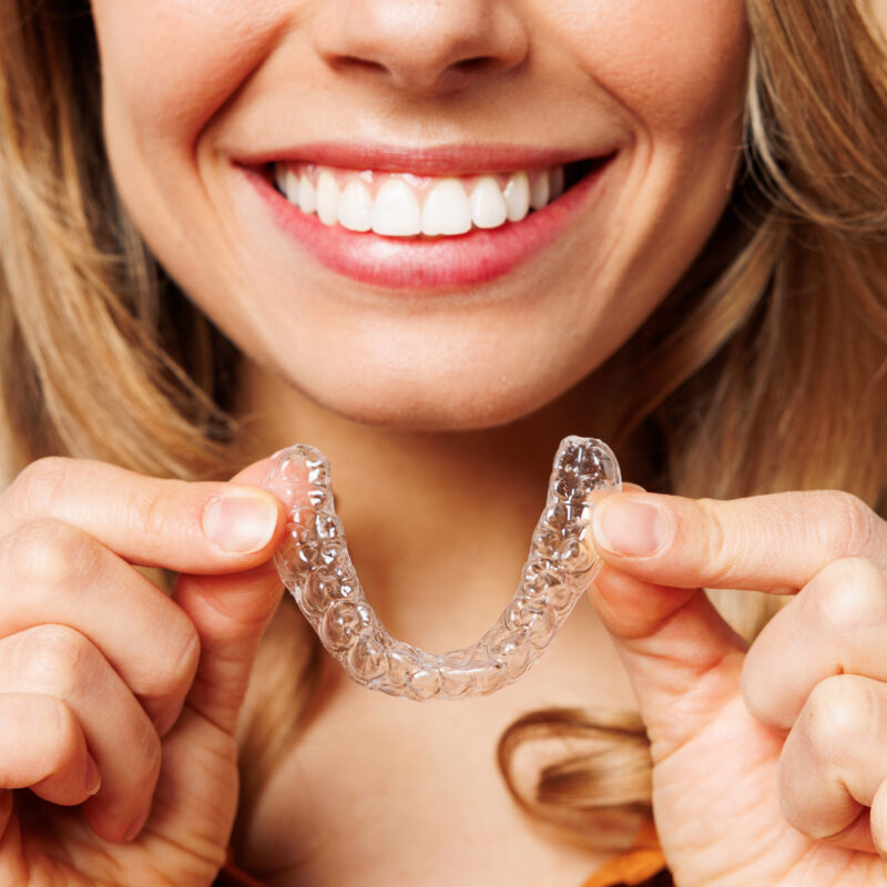 Close up cropped young woman wear orange shirt casual clothes hold in hand invisible transparent aligners, invisalign bracer smile isolated on plain pastel light beige background. Lifestyle concept