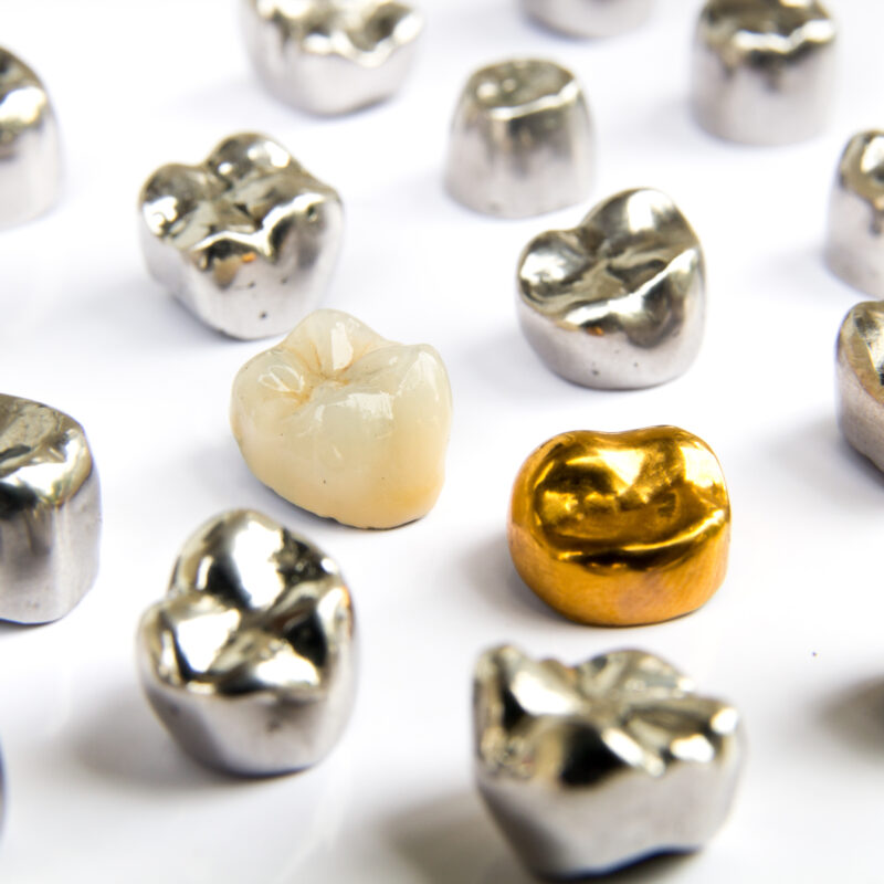 Dental ceramic, gold and metal tooth crowns on white background. Isolated.
