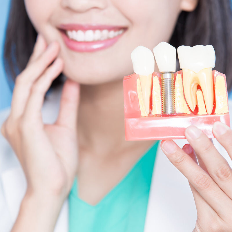 Close up Dental Implant